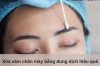 Xóa xăm chân mày bằng dung dịch hiệu quả