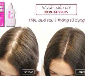 Tinh Chất Mọc Tóc Cho Nữ Kaminomoto Ladies EX