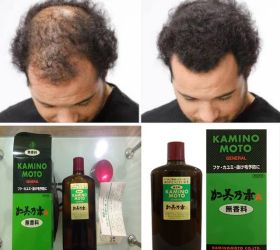Tinh Chất Đặc Trị Rụng Tóc Kaminomoto General