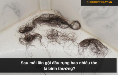 Sau mỗi lần gội đầu rụng bao nhiêu tóc là bình thường?