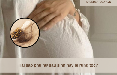 Giải đáp tại sao phụ nữ sau sinh hay bị rụng tóc?