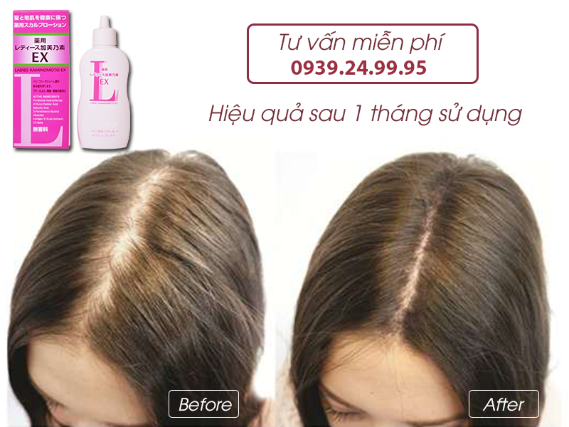 Tinh Chất Mọc Tóc Cho Nữ Kaminomoto Ladies EX