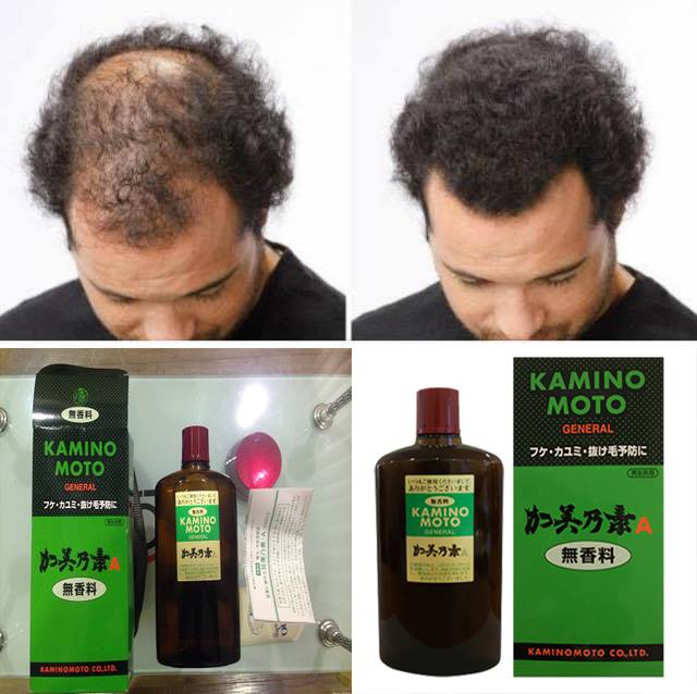 Tinh Chất Đặc Trị Rụng Tóc Kaminomoto General